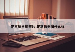 正常脑电图照片,正常脑电图什么样